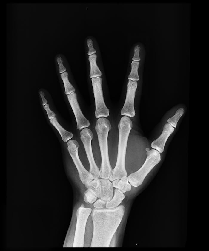 digital-01 High-resolution X-ray capturing the bones of a human hand, displaying skeletal anatomy.
